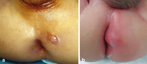 321246_1_En_35_Fig1_HTML